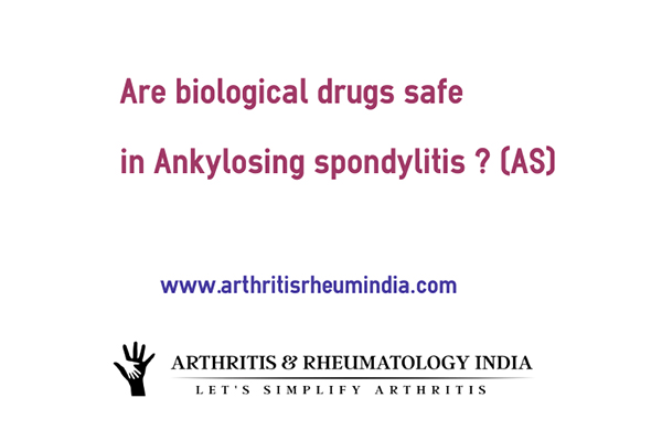 Is it safe to have biologics for Ankylosing spondylitis ?