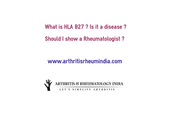 I have back pain and positive HLA B27 test – What disease I have ?