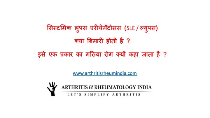 lupus_hindi lupus_hindi